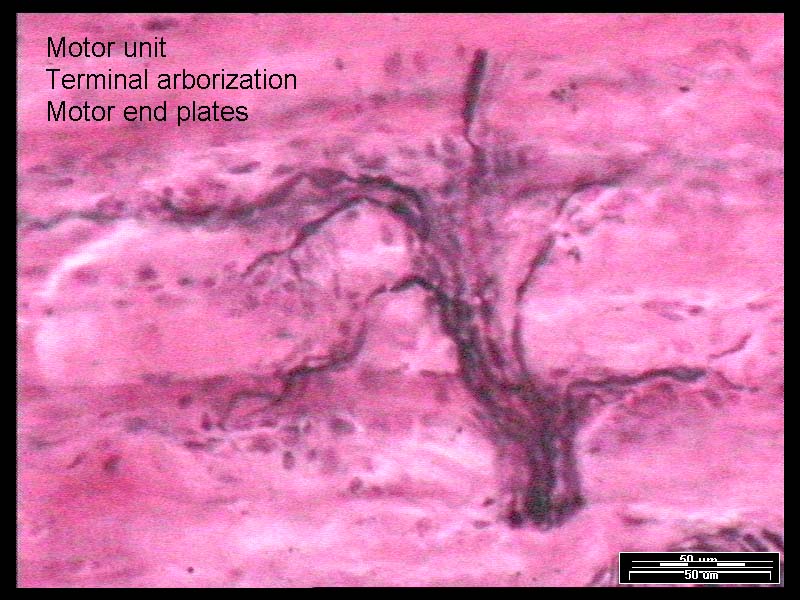 NERVOUS TISSUE - 26-Motor Unti.jpg